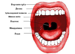 ангина венсана